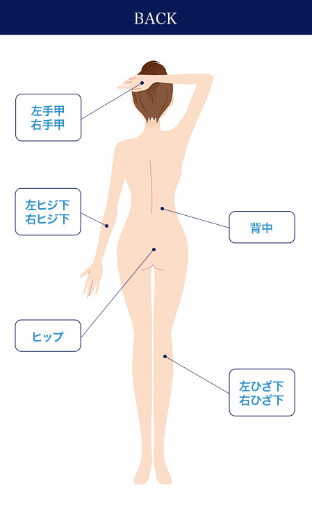 フレイアクリニックの全身脱毛の範囲②