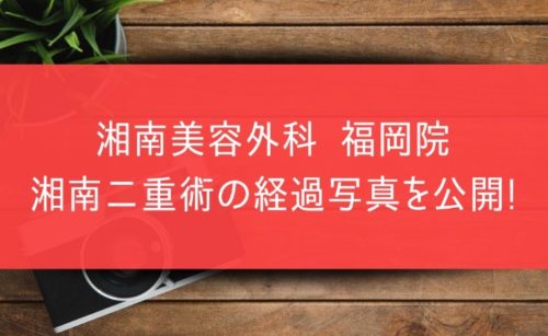 湘南美容外科 福岡院 湘南二重術の経過写真