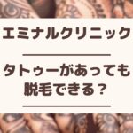 エミナルクリニックはタトゥーがあっても脱毛できる？